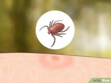 Определите укусы насекомых Шаг 5