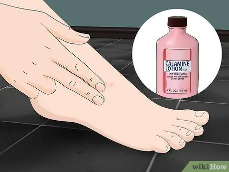 Лечить укусы песчаных блох Шаг 2