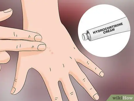 Лечить укусы песчаных блох Шаг 3