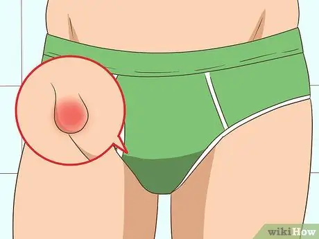 Лечить укусы чиггера, шаг 18