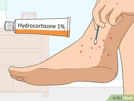 Лечить укусы чиггера, шаг 2