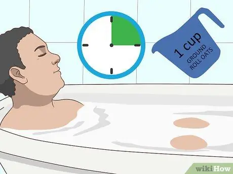 Лечить укусы чиггера Шаг 6