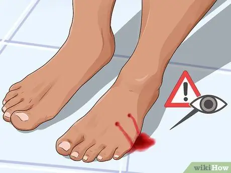 Узнайте, серьезен ли укус домашнего животного Шаг 3