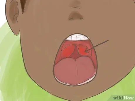 Научите ребенка жевать с закрытым ртом Шаг 10