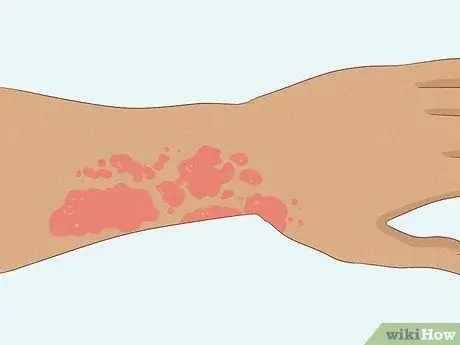 Какая польза для здоровья от пажитника Шаг 8