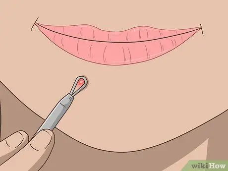 Избавиться от прыщей Шаг 2