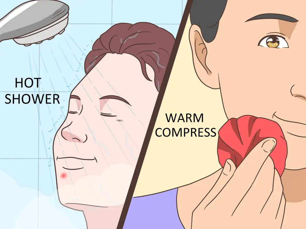 4 способа избавиться от прыща