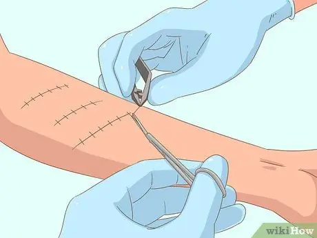 Выжить после атаки гепарда, шаг 14