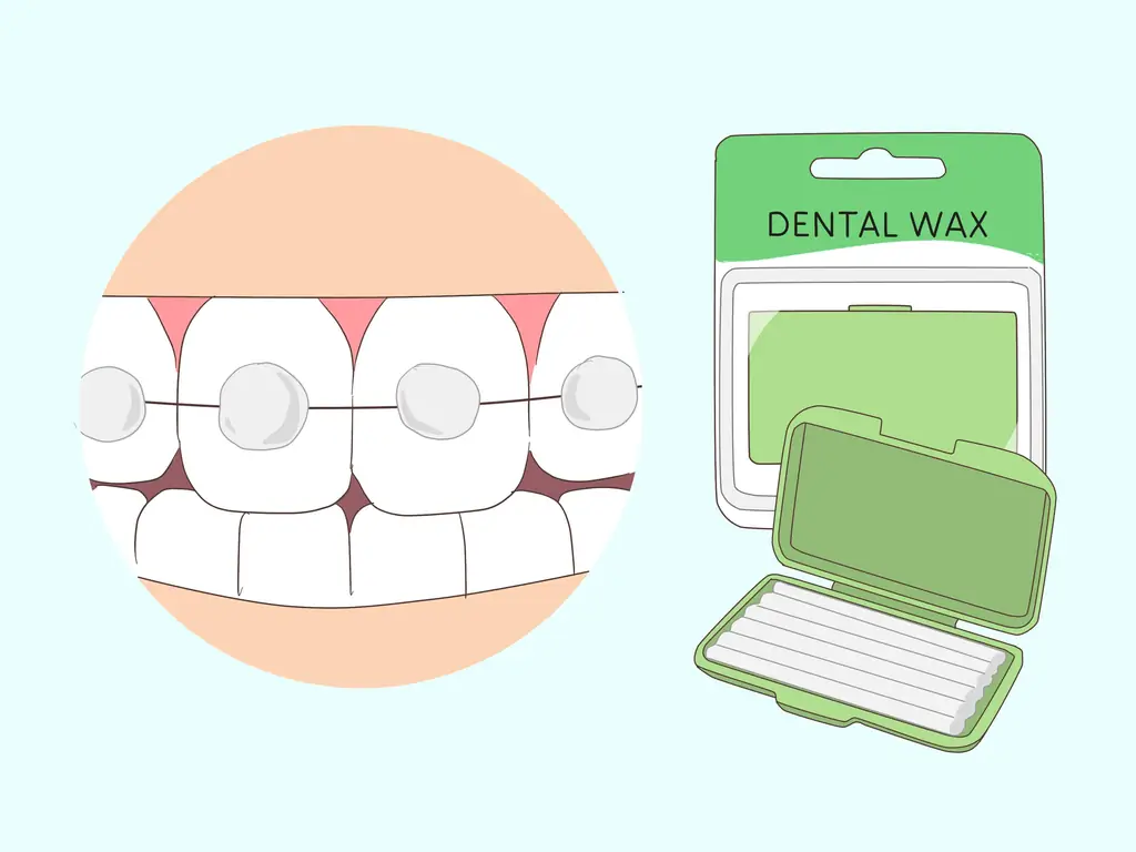 Как целоваться с подтяжками: 9 шагов (с иллюстрациями)