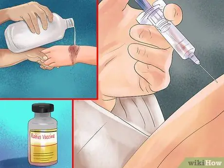 Предотвратить нападение обезьяны или выжить после нее, шаг 11