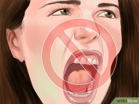 Предотвратить нападение обезьяны или выжить в ней Шаг 9