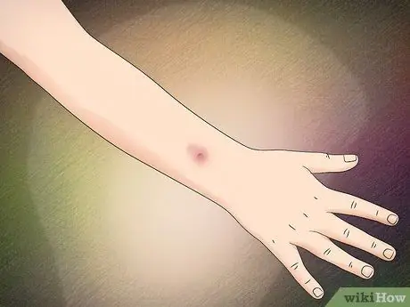 Определите паука-коричневую вдову. Шаг 11