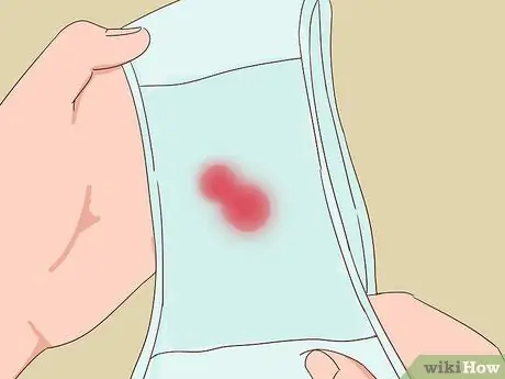 Как определить, началось ли у вас половое созревание (для девочек) Шаг 7