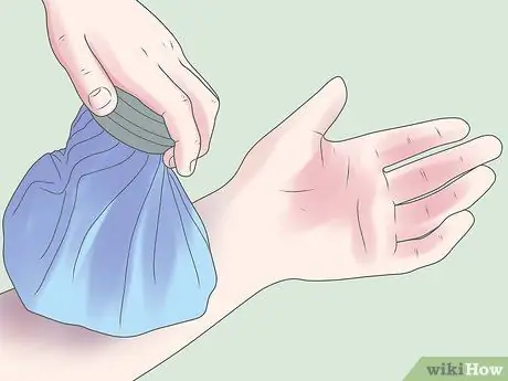 Уменьшение синяков, шаг 1