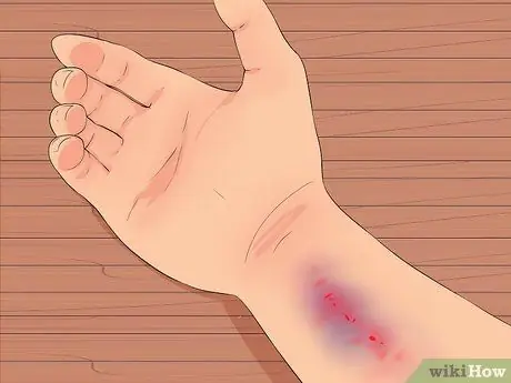 Оцените дом престарелых Шаг 17