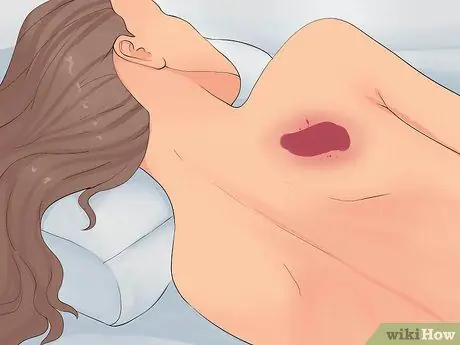 Оцените дом престарелых Шаг 18