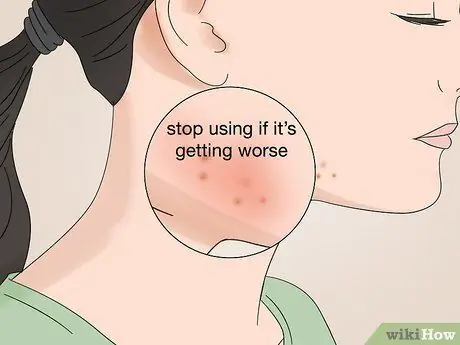 Используйте масло арганы от прыщей Шаг 10