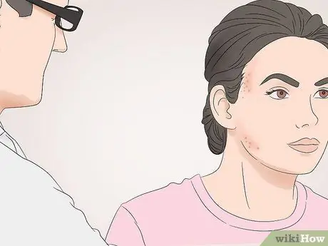 Используйте масло арганы от прыщей Шаг 12