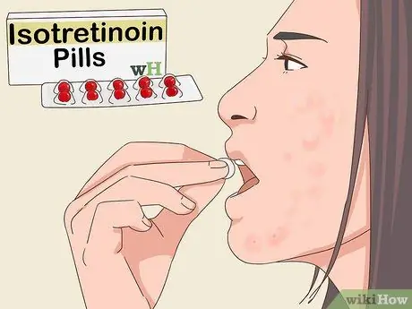 Лечить узловые прыщи Шаг 2