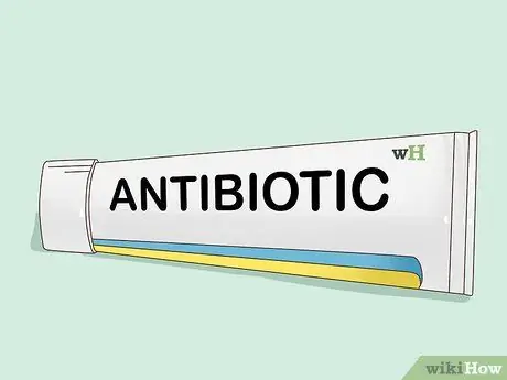 Лечить узелковые прыщи Шаг 4