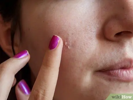 Используйте зеленые тени для век, чтобы скрыть красный прыщ. Шаг 1