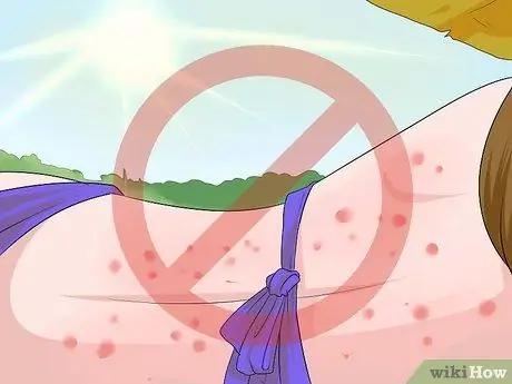 Быстрое избавление от прыщей на спине, шаг 13