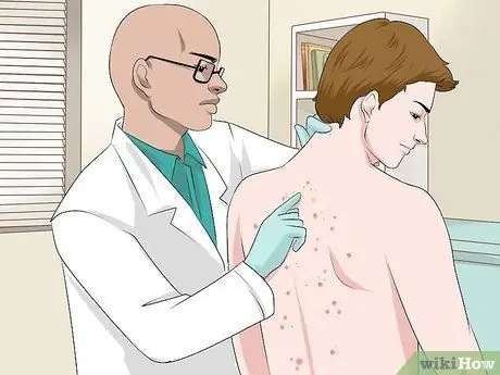 Быстрое избавление от прыщей на спине, шаг 4