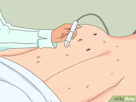 Удаление черных точек на спине Шаг 5