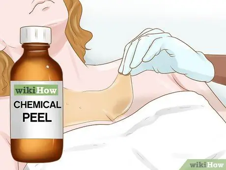 Избавьтесь от шрамов от прыщей на груди Шаг 5