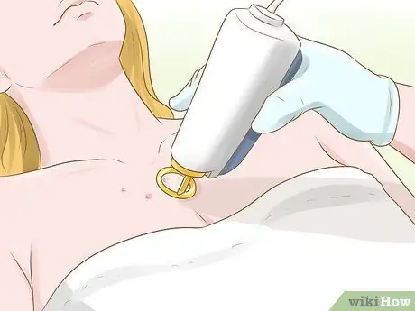 Избавьтесь от шрамов от прыщей на груди Шаг 9