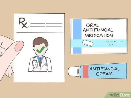 Лечить грибковые прыщи на спине Шаг 10