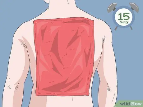 Лечить грибковые прыщи на спине Шаг 2