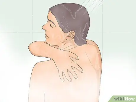 Избавиться от прыщей на спине естественным путем, шаг 1