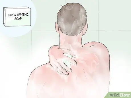 Как избавиться от прыщей на спине естественным путем, шаг 2