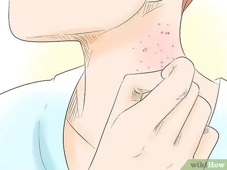 Перестань ковырять лицо Шаг 15