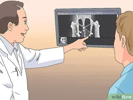 Как узнать, есть ли у вашего кролика слезящиеся глаза Шаг 10