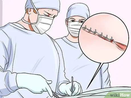 Диагностика лимфосаркомы кошек Шаг 10