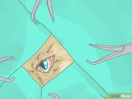 Лечить слезящиеся глаза у кошек Шаг 19