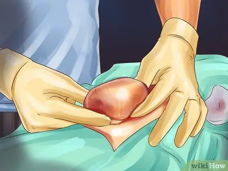 Лечить лимфому кишечника кошек Шаг 7