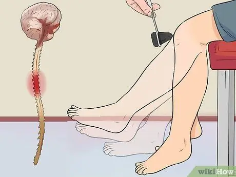 Проверка рефлексов Шаг 10