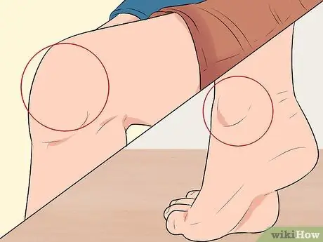 Проверка рефлексов, шаг 2