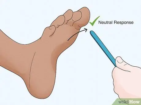 Проверьте рефлекс Бабинского, шаг 10