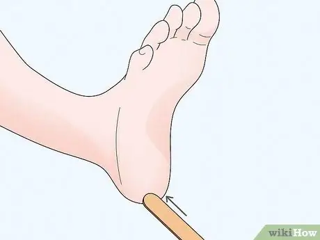 Проверьте рефлекс Бабинского, шаг 2