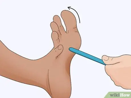 Проверьте рефлекс Бабинского, шаг 5