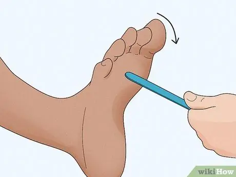 Проверьте рефлекс Бабинского, шаг 6