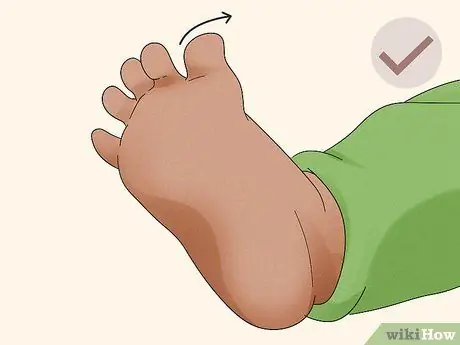 Проверьте рефлекс Бабинского, шаг 7