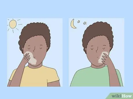 Нанесите перекись бензоила, шаг 8