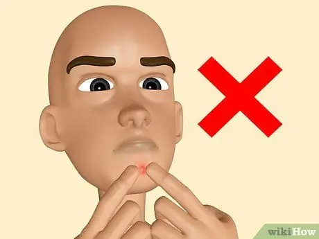 Сделайте свое собственное средство от прыщей Шаг 13