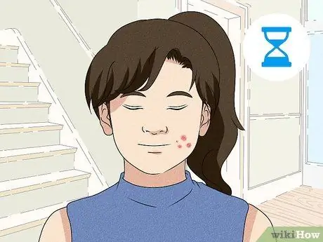 Лечение зудящих прыщей Шаг 12