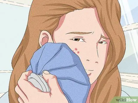 Исцеление от зудящих прыщей, шаг 2